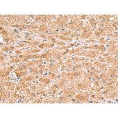 Solarbio K009850P Anti-HMGCLL1 Polyclonal Antibody