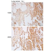 Solarbio K112282P Anti-RBPMS Polyclonal Antibody