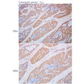 Solarbio K112211P Anti-ARHGAP35 Polyclonal Antibody