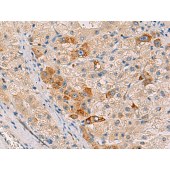 Solarbio K009853P Anti-RMDN2 Polyclonal Antibody