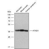 Solarbio K009823P Anti-ATAD1 Polyclonal Antibody