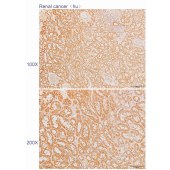 Solarbio K110277P Anti-SMURF2 Polyclonal Antibody
