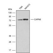 Solarbio K009900P Anti-CAPN6 Polyclonal Antibody