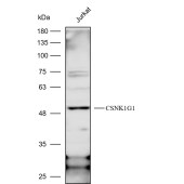 Solarbio K112257P Anti-CSNK1G1 Polyclonal Antibody