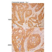 Solarbio K112231P Anti-SURF1 Polyclonal Antibody