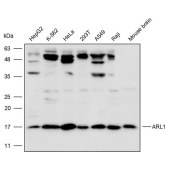 Solarbio K110523P Anti-ARL1 Polyclonal Antibody