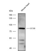 Solarbio K112292P Anti-GUSB Polyclonal Antibody