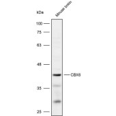 Solarbio K109939P Anti-CBX6 Polyclonal Antibody