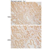 Solarbio K110020P Anti-CHN1 Polyclonal Antibody