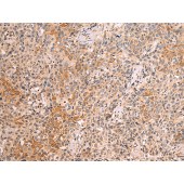 Solarbio K009839P Anti-RAB29 Polyclonal Antibody