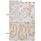 Solarbio K110289P Anti-TIRAP Polyclonal Antibody