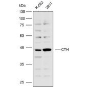 Solarbio K110337P Anti-CTH Polyclonal Antibody