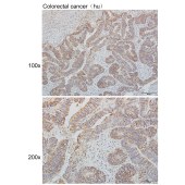 Solarbio K110354P Anti-SND1 Polyclonal Antibody
