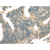 Solarbio K009827P Anti-CNTNAP2 Polyclonal Antibody