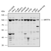 Solarbio K110461P Anti-MRTFA Polyclonal Antibody