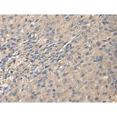 Solarbio K009858P Anti-ZG16 Polyclonal Antibody