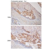 Solarbio K112165P Anti-NBEAL1 Polyclonal Antibody