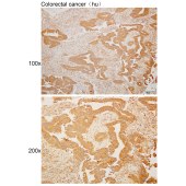 Solarbio K110458P Anti-STK39 Polyclonal Antibody