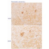 Solarbio K110295P Anti-IL12A Polyclonal Antibody