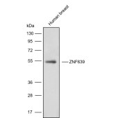 Solarbio K009873P Anti-ZNF639 Polyclonal Antibody