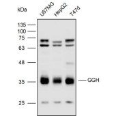 Solarbio K110070P Anti-GGH Polyclonal Antibody