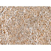 Solarbio K009841P Anti-DTYMK Polyclonal Antibody