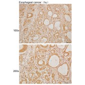 Solarbio K110003P Anti-ADAP2 Polyclonal Antibody