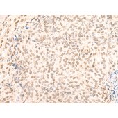 Solarbio K009836P Anti-GTF2F1 Polyclonal Antibody