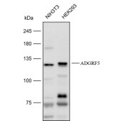 Solarbio K112162P Anti-ADGRF5 Polyclonal Antibody