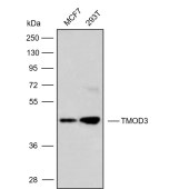 Solarbio K009864P Anti-TMOD3 Polyclonal Antibody