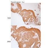 Solarbio K112200P Anti-MAP3K1 Polyclonal Antibody