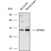 Solarbio K110274P Anti-SPSB4 Polyclonal Antibody