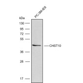 Solarbio K009830P Anti-CHST10 Polyclonal Antibody