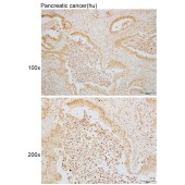 Solarbio K110058P Anti-XRN2 Polyclonal Antibody