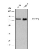 Solarbio K009836P Anti-GTF2F1 Polyclonal Antibody