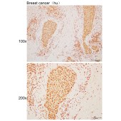 Solarbio K110517P Anti-SET Polyclonal Antibody