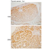 Solarbio K110408P Anti-IL18 Polyclonal Antibody