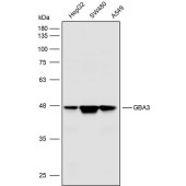 Solarbio K110329P Anti-GBA3 Polyclonal Antibody
