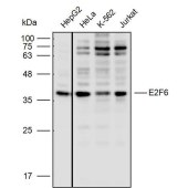 Solarbio K110519P Anti-E2F6 Polyclonal Antibody