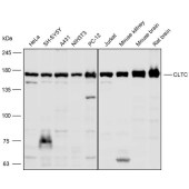 Solarbio K110284P Anti-CLTC Polyclonal Antibody