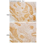 Solarbio K110043P Anti-MYO19 Polyclonal Antibody