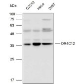 Solarbio K110301P Anti-OR4C12 Polyclonal Antibody