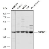 Solarbio K110304P Anti-SUCNR1 Polyclonal Antibody