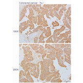 Solarbio K110285P Anti-MAOB Polyclonal Antibody