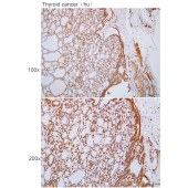 Solarbio K112308P Anti-ADAL Polyclonal Antibody
