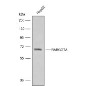 Solarbio K009843P Anti-RABGGTA Polyclonal Antibody