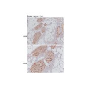 Solarbio K001776P Anti-HSPD1 Polyclonal Antibody