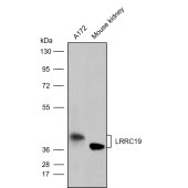 Solarbio K009813P Anti-LRRC19 Polyclonal Antibody