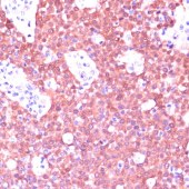Solarbio K009357P Anti-CDKN2A/p16INK4a  Rabbit Polyclonal Antibody