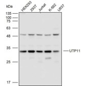 Solarbio K110084P Anti-UTP11 Polyclonal Antibody